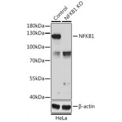 Nuclear Factor NF-Kappa-B P105 Subunit (NFKB1) Antibody