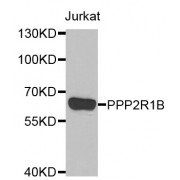 Western blot analysis of extracts of Jurkat cells, using PPP2R1B antibody (abx005142) at 1/1000 dilution.
