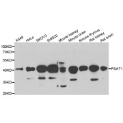 Western blot analysis of extracts of various cell lines, using PSAT1 antibody (abx005144) at 1/1000 dilution.