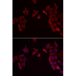 Receptor Activity Modifying Protein 3 (RAMP3) Antibody