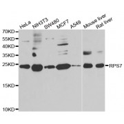 Western blot analysis of extracts of various cell lines, using RPS7 antibody (abx005163) at 1/1000 dilution.