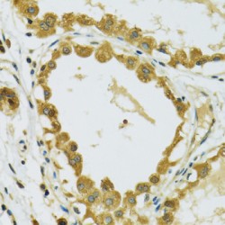 Ribosomal Protein S7 (RPS7) Antibody