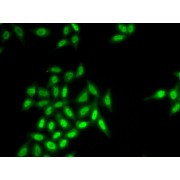 Immunofluorescence analysis of HeLa cells using SETMAR antibody (abx005169).