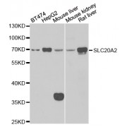 Western blot analysis of extracts of various cell lines, using SLC20A2 antibody (abx005170) at 1/1000 dilution.