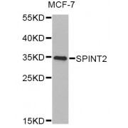 Western blot analysis of extracts of MCF-7 cells, using SPINT2 Antibody (abx005176) at 1/1000 dilution.