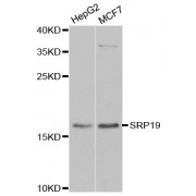 Western blot analysis of extracts of various cell lines, using SRP19 antibody (abx005178) at 1/1000 dilution.