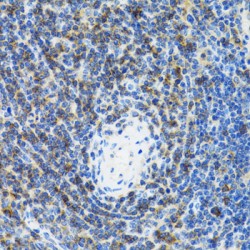 Signal Recognition Particle 19 (SRP19) Antibody
