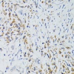 Signal Recognition Particle 19 (SRP19) Antibody