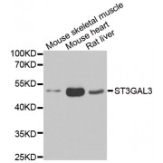 Western blot analysis of extracts of various cell lines, using ST3GAL3 antibody (abx005179) at 1/1000 dilution.
