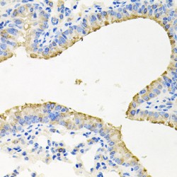 Striatin-3 (STRN3) Antibody