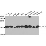 Western blot analysis of extracts of various cell lines, using TOMM20 antibody (abx005196) at 1/1000 dilution.
