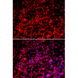 Translocase of Outer Mitochondrial Membrane 20 (TOMM20) Antibody