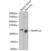 Western blot analysis of extracts of various cell lines, using TRAPPC10 antibody (abx005199) at 1/1000 dilution.
