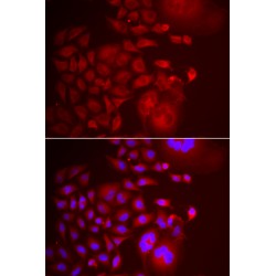 Trafficking Protein Particle Complex Subunit 10 (TRAPPC10) Antibody