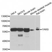 Western blot analysis of extracts of various cell lines, using YARS antibody (abx005209) at 1/1000 dilution.
