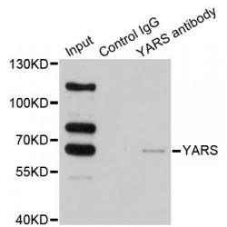 Tyrosine-tRNA Ligase, Cytoplasmic (YARS1) Antibody