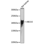 Western blot analysis of extracts of Rat kidney using ABCA3 antibody (1/1000 dilution).