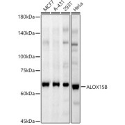 Western blot analysis of MCF7 (Lane 1), A431 (Lane 2), 293T (Lane 3) and HeLa (Lane 4) cell lysates (25 µg per lane) using Polyunsaturated Fatty Acid Lipoxygenase ALOX15B Antibody (1/1000 dilution) followed by HRP-conjugated Goat Anti-Rabbit IgG H+L (<a href="https://www.abbexa.com/index.php?route=product/request&search=abx005548">abx005548</a>, 1/10000 dilution) and 3% non-fat dry milk in TBST for blocking..