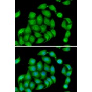 Immunofluorescence analysis of HeLa cells using ASPH antibody (abx005236). Blue: DAPI for nuclear staining.