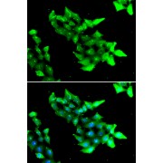 Immunofluorescence analysis of HeLa cells using KRIT1 antibody (abx005240). Blue: DAPI for nuclear staining.