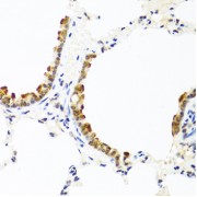 Immunohistochemistry of paraffin-embedded rat lung using COL10A1 antibody (abx005244) at dilution of 1/100 (40x lens).