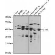 Western blot analysis of extracts of various cell lines, using CTNS antibody (1/1000 dilution).