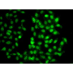 26S Proteasome Non-ATPase Regulatory Subunit 8 (PSMD8) Antibody