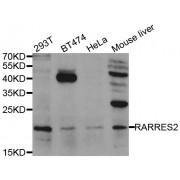 Western blot analysis of extracts of various cell lines, using RARRES2 antibody (abx005282) at 1/1000 dilution.