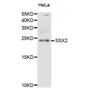 Western blot analysis of extracts of HeLa cells, using SSX2 antibody (abx005298) at 1/1000 dilution.
