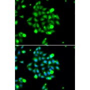 Immunofluorescence analysis of U2OS cells using UBE2G1 antibody (abx005302). Blue: DAPI for nuclear staining.