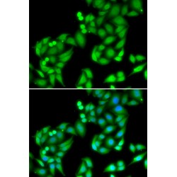 COP9 Signalosome Subunit 3 (COPS3) Antibody