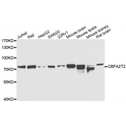 Western blot analysis of extracts of various cell lines, using CBFA2T2 antibody (abx005323, 1/1000 dilution) followed by secondary antibody HRP-Conjugated Goat Anti-Rabbit IgG, H+L (<a href = "https://www.abbexa.com/goat-anti-rabbit-igg-hl-antibody-hrp-p-44932">abx005548</a>, 1/10000 dilution), and 3% non-fat dried milk in TBST for blocking.