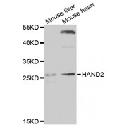 Western blot analysis of extracts of various cell lines, using HAND2 antibody (abx005333) at 1/1000 dilution.
