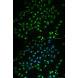 Heart And Neural Crest Derivatives Expressed Protein Protein 2 (HAND2) Antibody