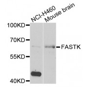 Western blot analysis of extracts of various cell lines, using FASTK antibody (abx005347) at 1/1000 dilution.