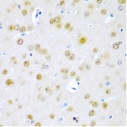 Immunohistochemistry of paraffin-embedded rat brain using TUSC2 antibody (abx005352) at dilution of 1/200 (40x lens).