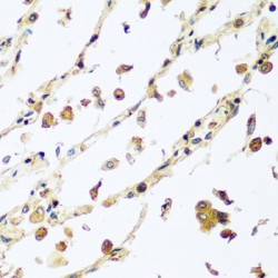 Vacuolar Protein Sorting-Associated Protein 4A (VPS4A) Antibody