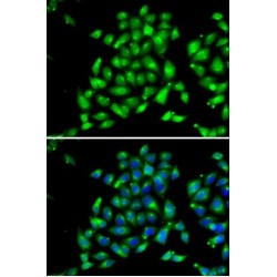 ADP-Ribosylation Factor GTPase Activating Protein 1 (ARFGAP1) Antibody