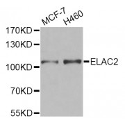 Western blot analysis of extracts of various cell lines, using ELAC2 Antibody (abx005382) at 1/1000 dilution.