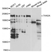 Western blot analysis of extracts of various cell lines, using THADA antibody (abx005383) at 1/1000 dilution.