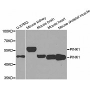 Western blot analysis of extracts of various cell lines, using PINK1 antibody (abx005385) at 1/1000 dilution.