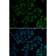 Immunofluorescence analysis of A549 cells using U2AF1L4 antibody (abx005397). Blue: DAPI for nuclear staining.