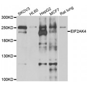 Western blot analysis of extracts of various cell lines, using EIF2AK4 antibody (abx005399) at 1/1000 dilution.