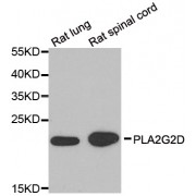 Western blot analysis of extracts of various cell lines, using PLA2G2D antibody (abx005407) at 1/1000 dilution.