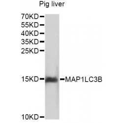Microtubule-Associated Proteins 1A/1B Light Chain 3B (MAP1LC3B) Antibody