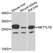 Western blot analysis of extracts of various cell lines, using METTL7B antibody (abx005434) at 1/1000 dilution.