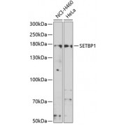 Western blot analysis of extracts of various cell lines using SETBP1 antibody (1/1000 dilution).