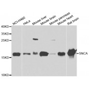Western blot analysis of extracts of various cell lines, using SNCA antibody (abx005446) at 1/1000 dilution.