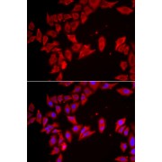 Immunofluorescence analysis of HeLa cells using SLC35A2 antibody (abx005460). Blue: DAPI for nuclear staining.