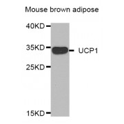 Western blot analysis of extracts of mouse brown adipose, using UCP1 antibody (abx005463).
